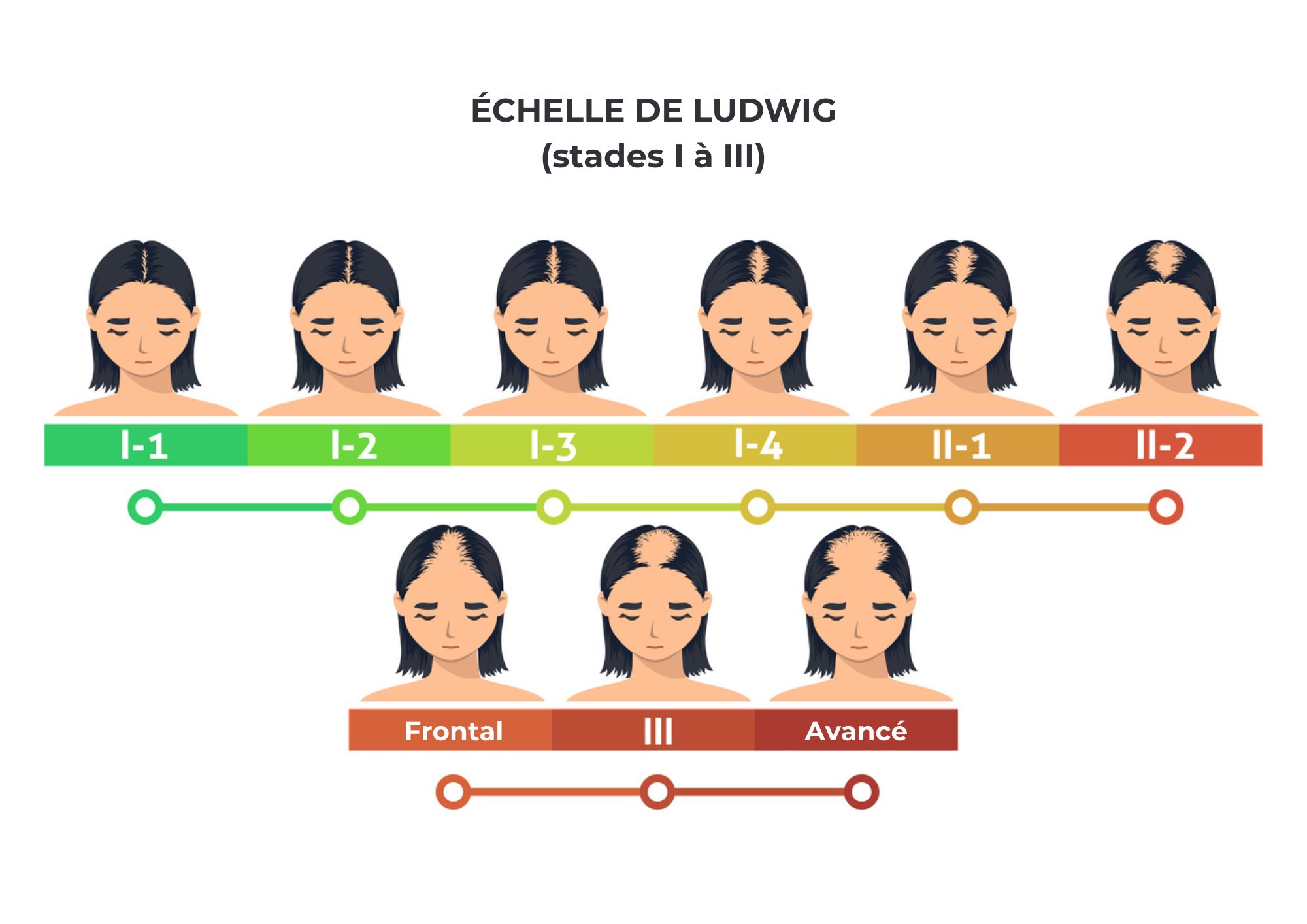Perte De Cheveux Chez La Femme Cause Et Solution Jaldes